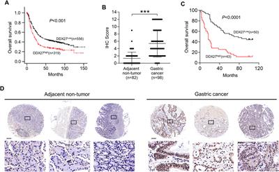 DEAD-Box Helicase 27 Triggers Epithelial to Mesenchymal Transition by Regulating Alternative Splicing of Lipoma-Preferred Partner in Gastric Cancer Metastasis